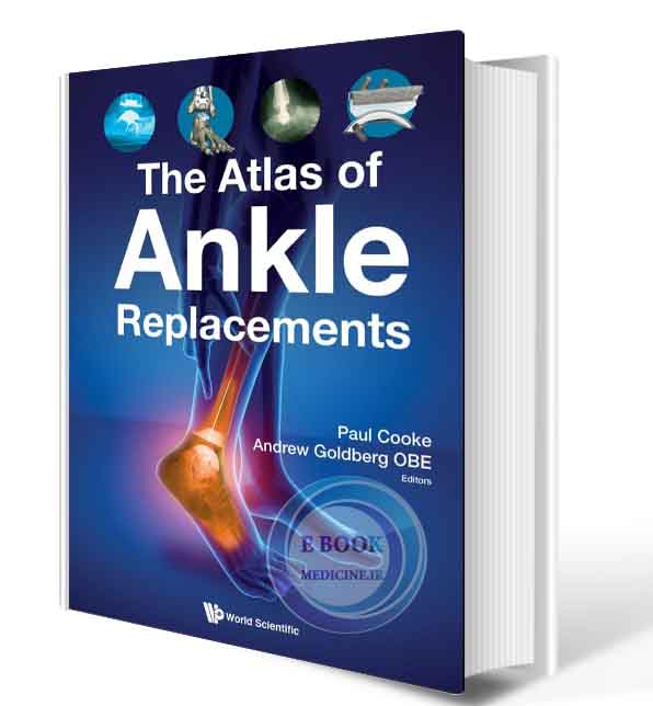 دانلود کتابThe Atlas of Ankle Replacements  2021 (ORIGINAL PDF)